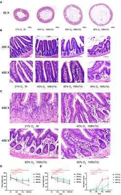 Hyperoxia Provokes Time- and Dose-Dependent Gut Injury and Endotoxemia and Alters Gut Microbiome and Transcriptome in Mice